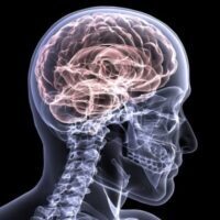Is Grey Matter a Grey Area Following a Concussion?